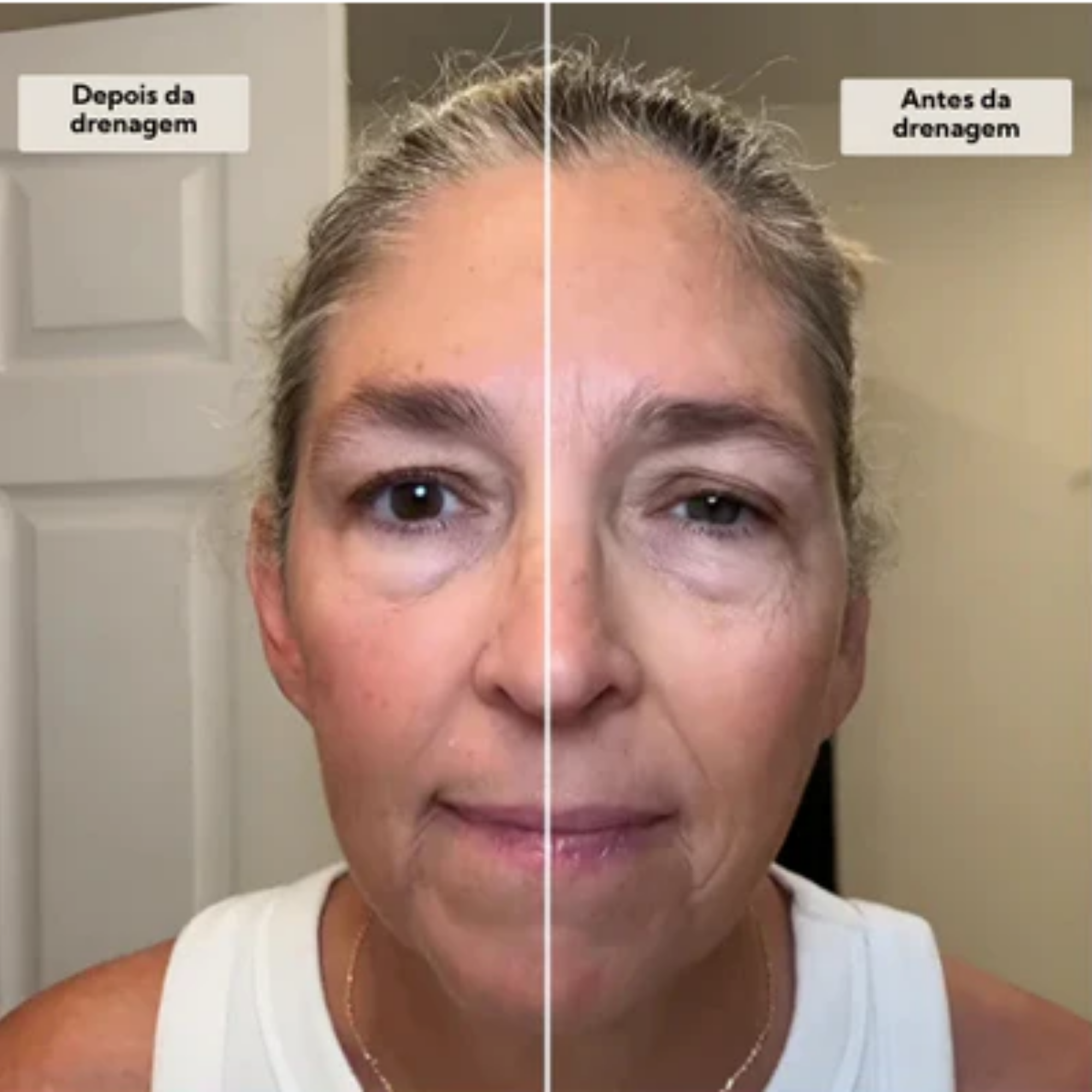 Koralift - Escova de Drenagem Facial